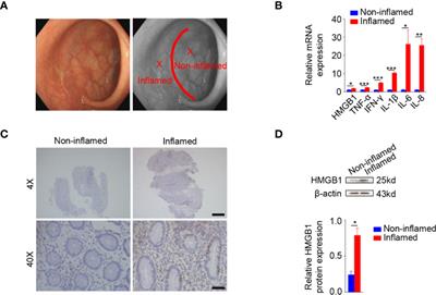 Anti-High Mobility Group Box 1 Neutralizing-Antibody Ameliorates Dextran Sodium Sulfate Colitis in Mice